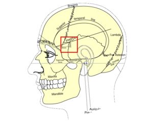 cranio
