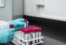 Sangue do cordão umbilical com vantagens nas Perturbações do Espetro do Autismo